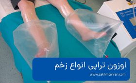 اوزون تراپی زخم